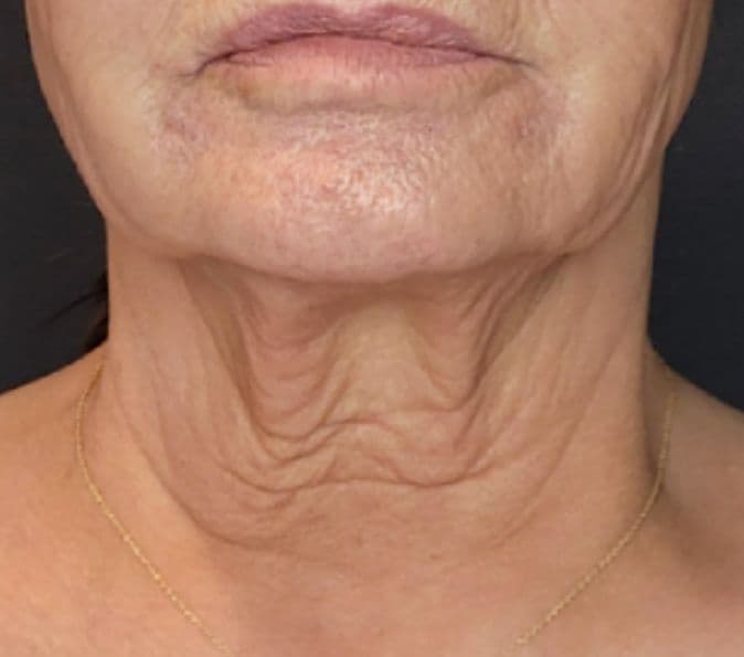 Борода — До